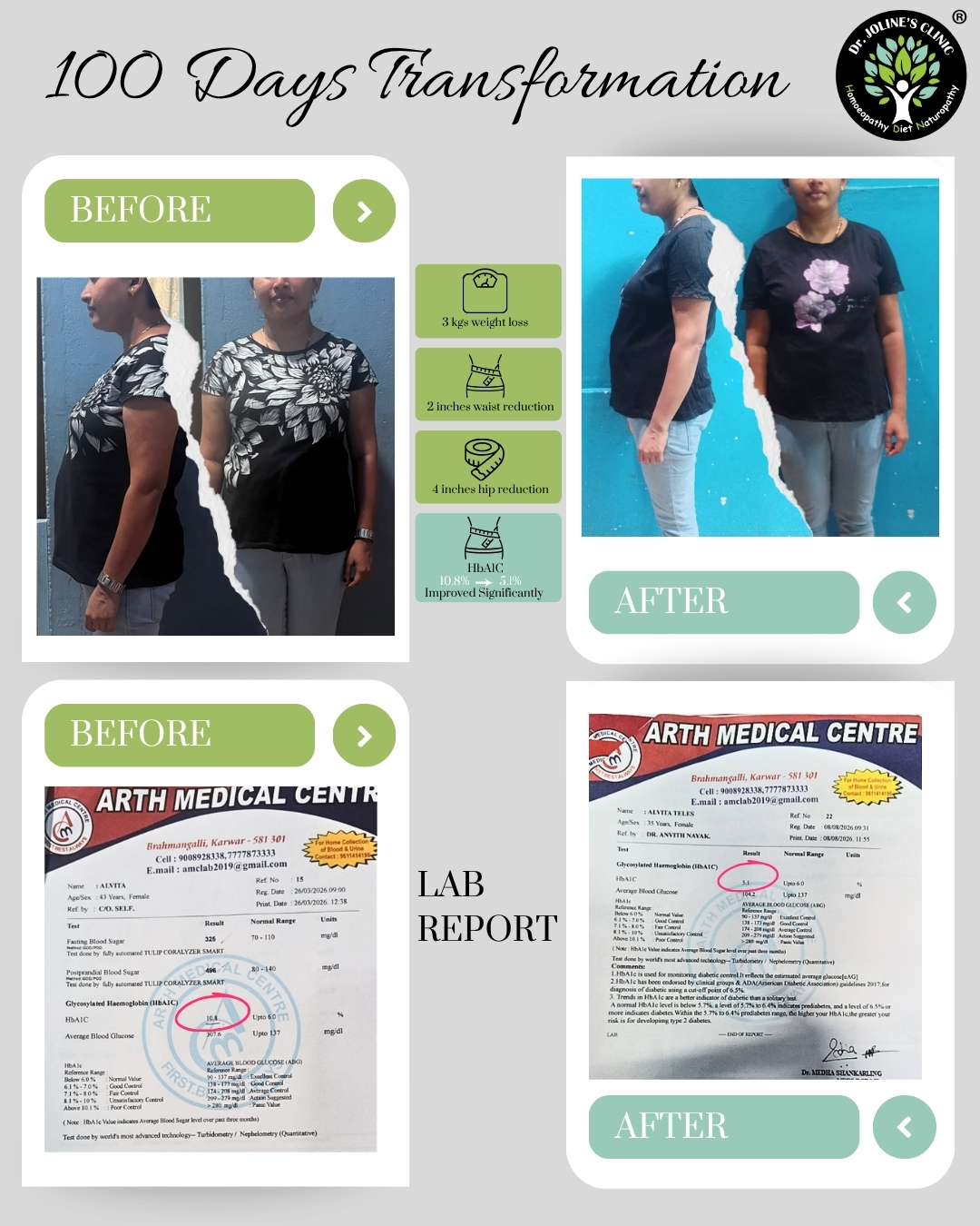 Alvita Teles’ 100-Day Blood Sugar, PCOS & Fat Loss Transformation